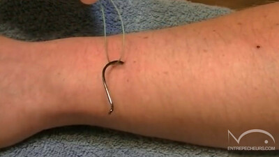 Retirer un hameçon de son bras